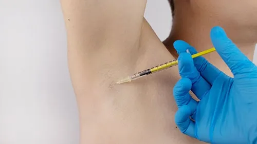 Imagem Toxina botulínica para suor excessivo nas axilas